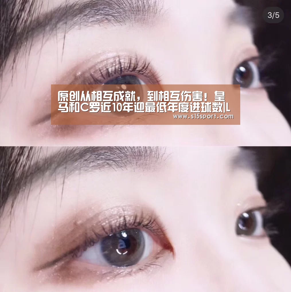 LoL投注网站 | 2026年最佳英雄联盟投注网站